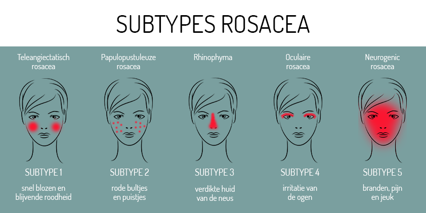subtypes rosacea