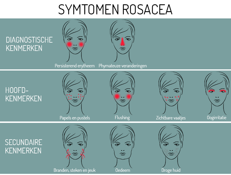 symptomen rosacea