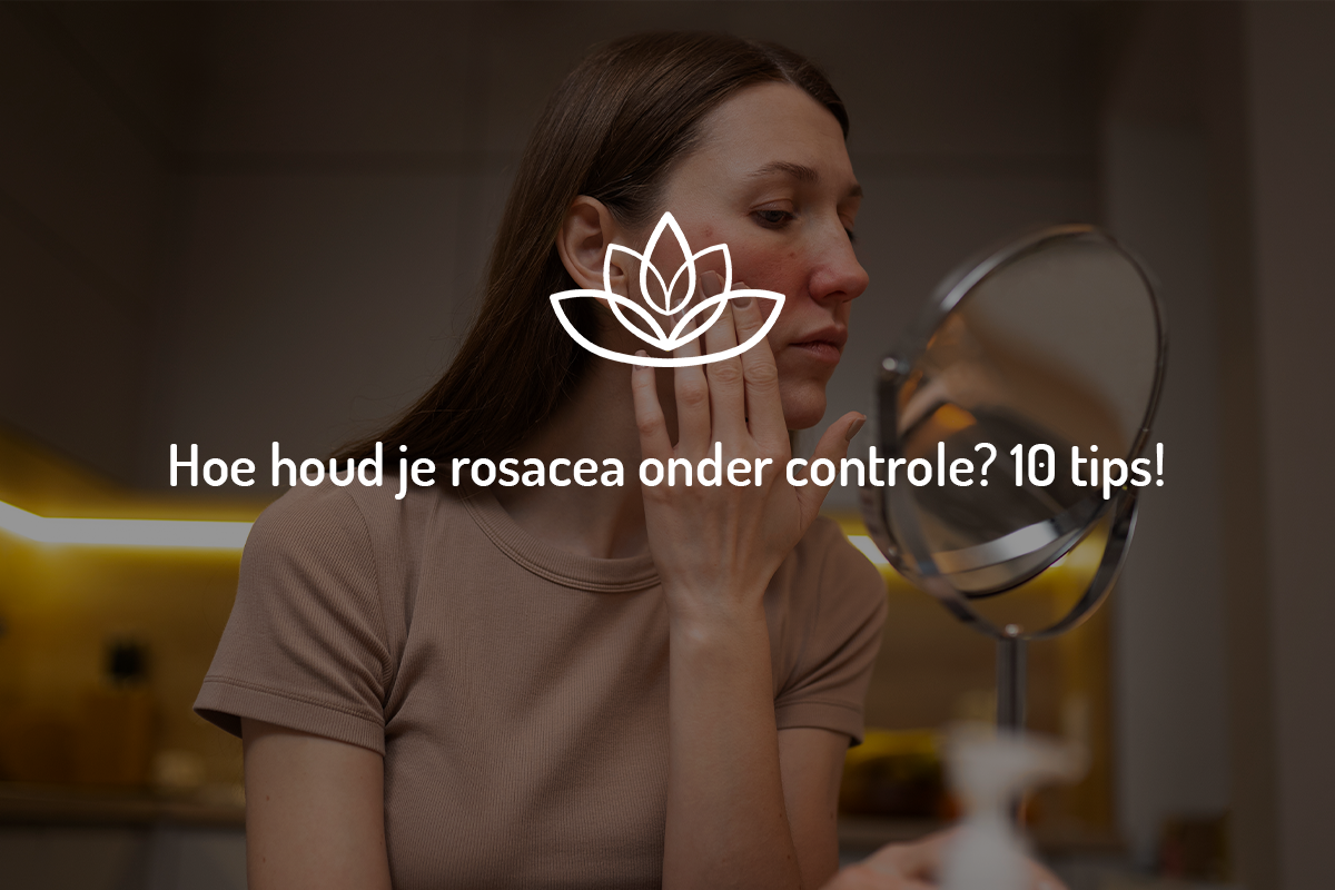 Hoe houd je rosacea onder controle Hoe houd je rosacea onder controle